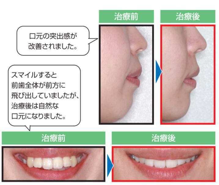 修正画像.jpg