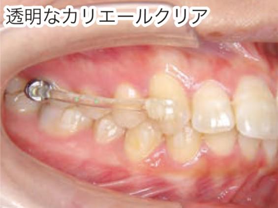 cms1583978806.jpg