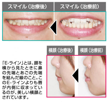 cms1618980101.jpg