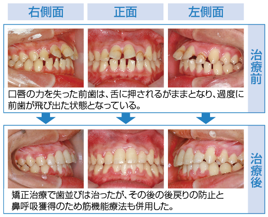 cms1438905297.png